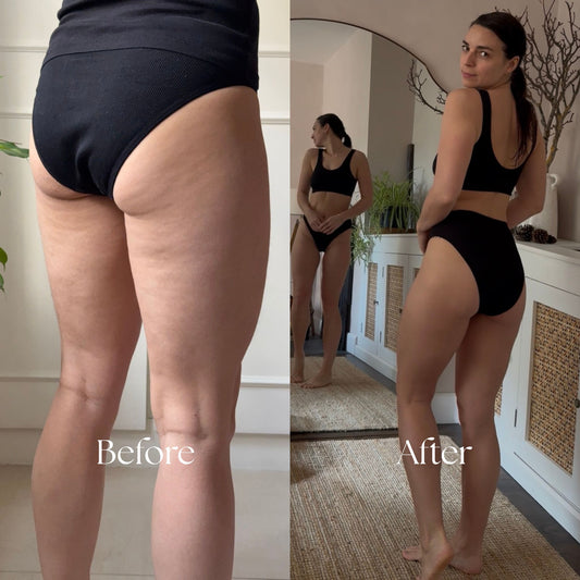 Electric Cupping & Gua Sha Massager